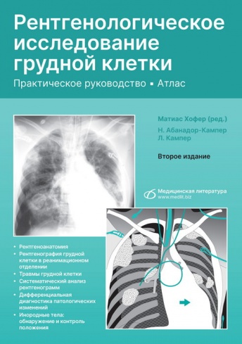 Рентгенологическое исследование грудной клетки. Практическое руководство. Атлас. 2-е издание, перераб. и доп.